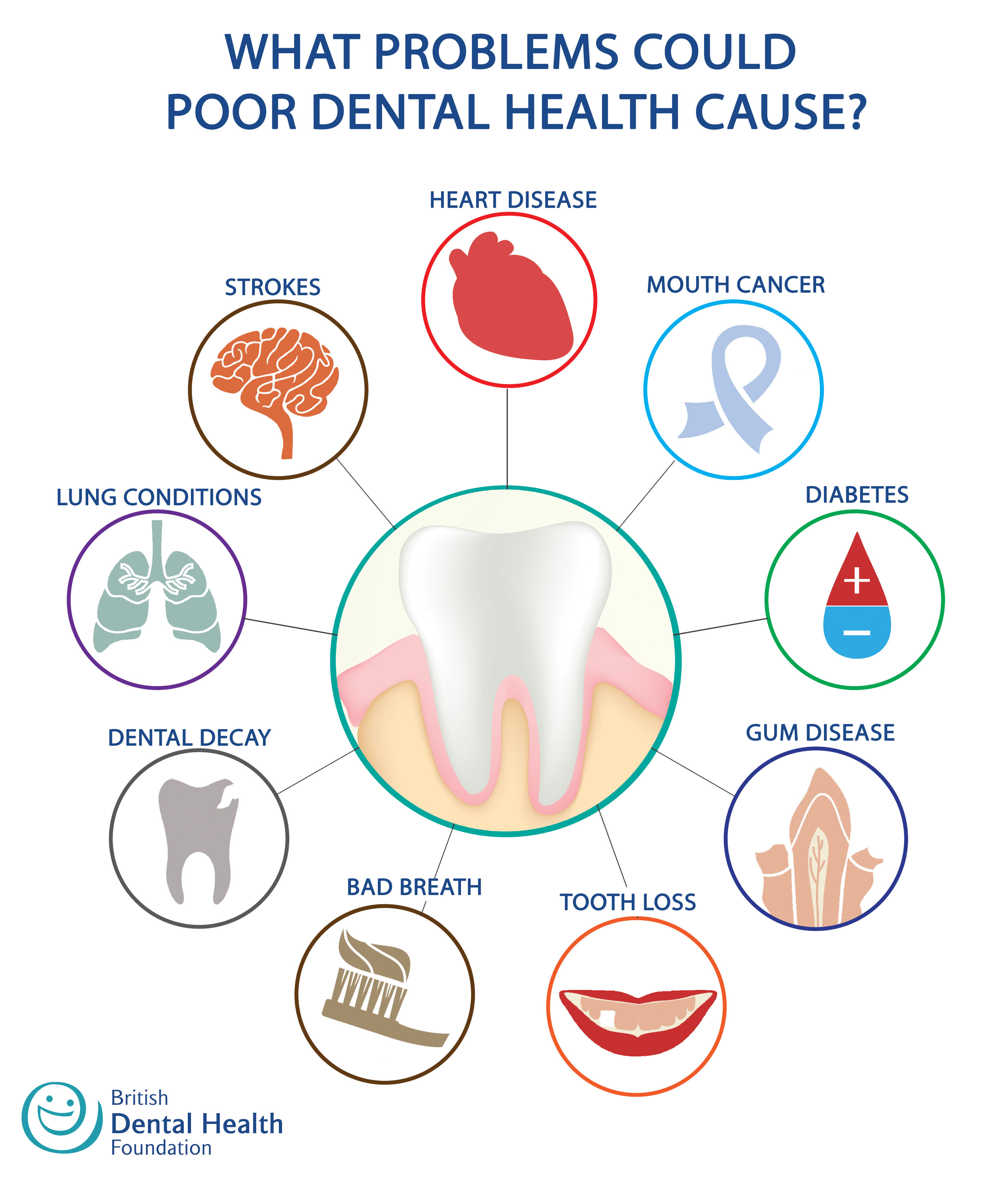 Poor Teeth may Lead to other Health Issues and/or Complications