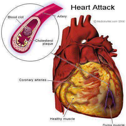 Drink Water on Empty Stomach