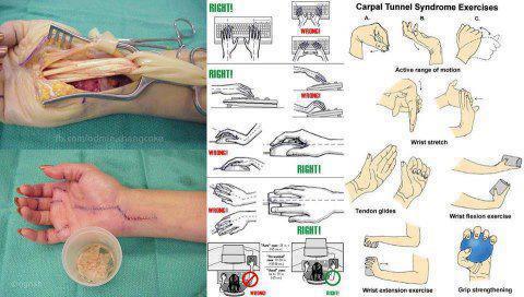 Computer User Beware of Your Wrist