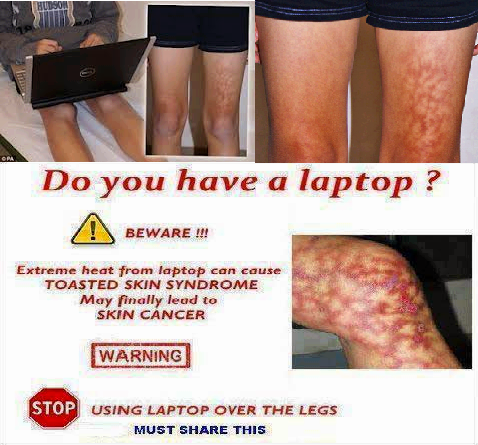 Beware Laptop Users