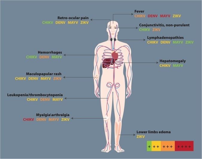 10 Symptoms of 4 Virus Epidemic Outbreak